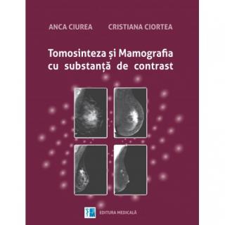 Tomosinteza si mamografia cu substanta de contrast