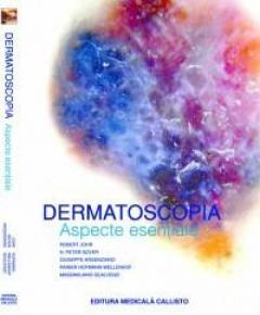 Dermatoscopie. Aspecte Esentiale