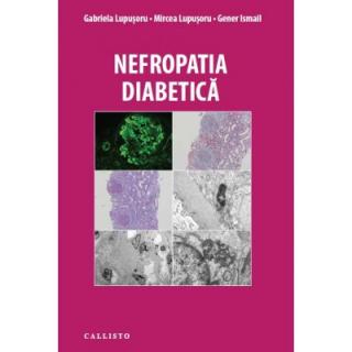 Nefropatia Diabetica