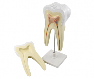 Molar cu 3 radacini
