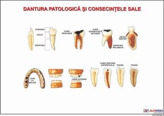 Patologia dintilor